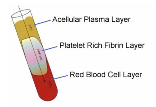 Review: Effectiveness of Injectable Platelet-Rich Fibrin Therapy in Alopecia and Facial Rejuvenation: A Systematic Review